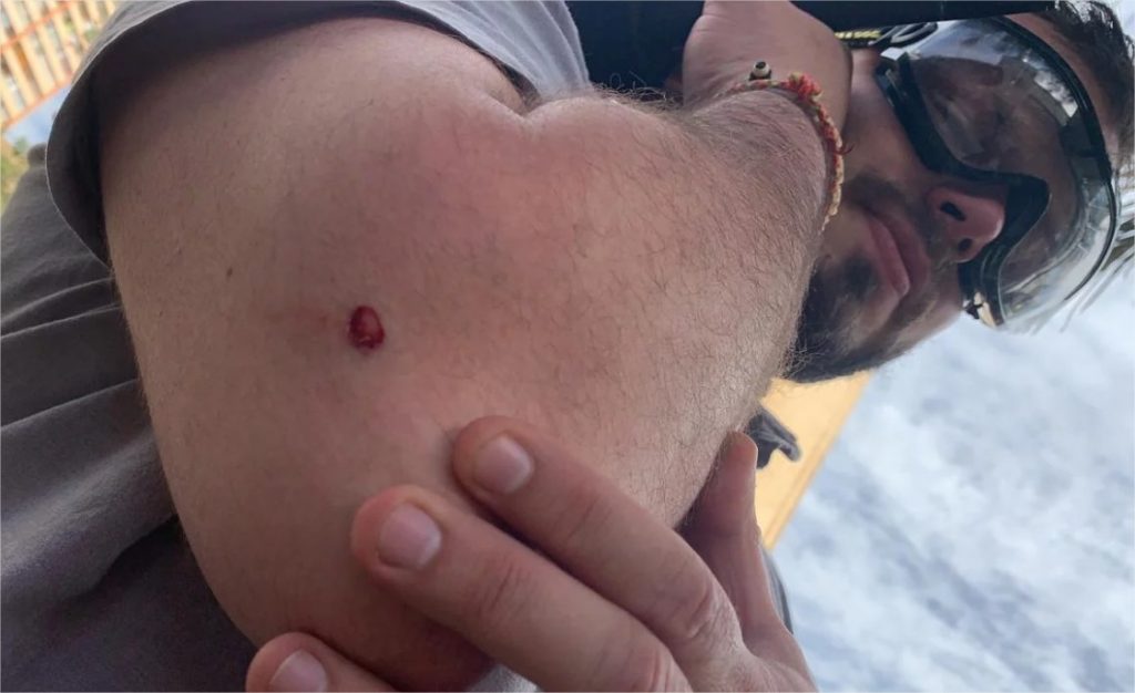 Periodista argentino herido por carabineros